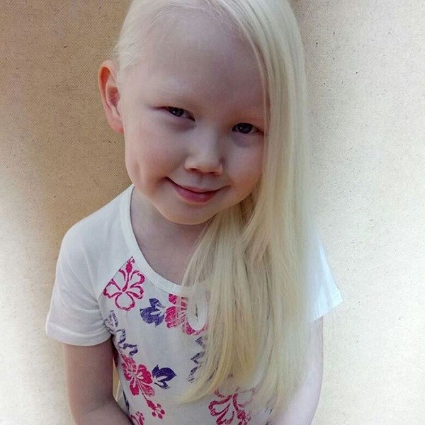 Nariyana the albino girls modeling career1